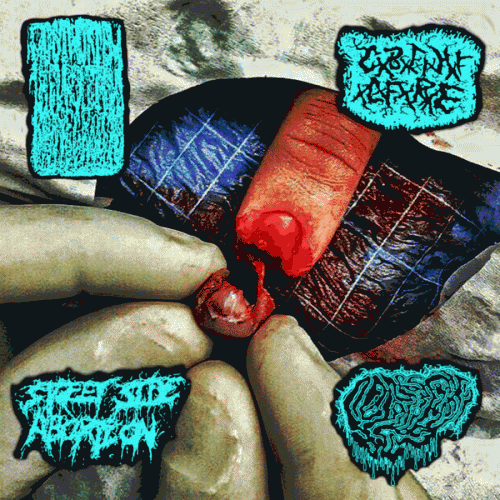 Catastrophic Blunt Force Intracranial Haemorrhage Fluid Leaking From Ruptured Eardrums : 4 Way Ear Splitting Noise